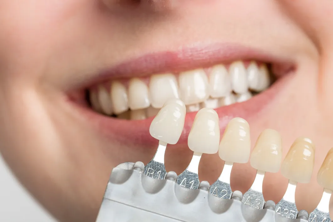 tooth whitening2