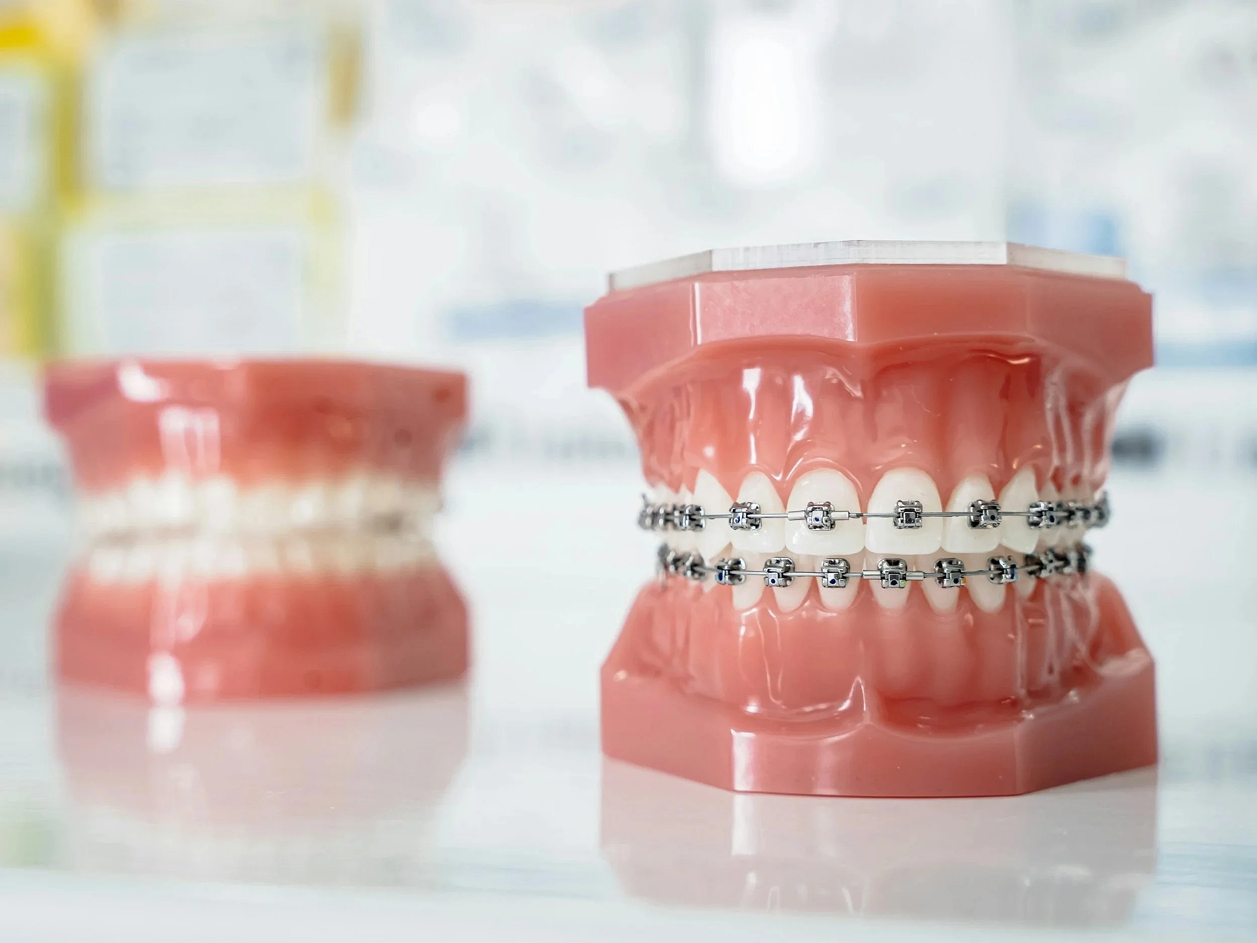fixed braces