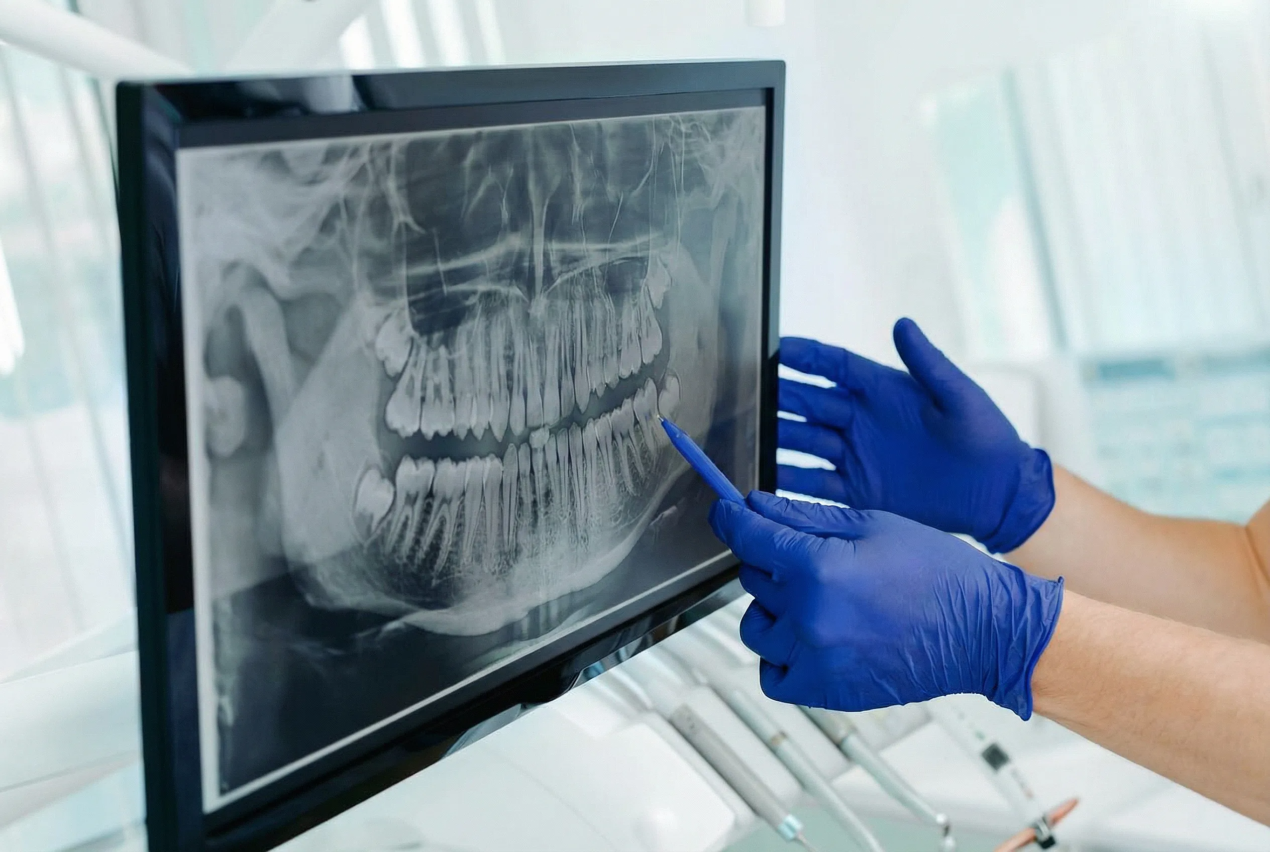 pointing at xray